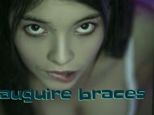 Nauguire_braces