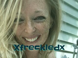 Xfreckledx